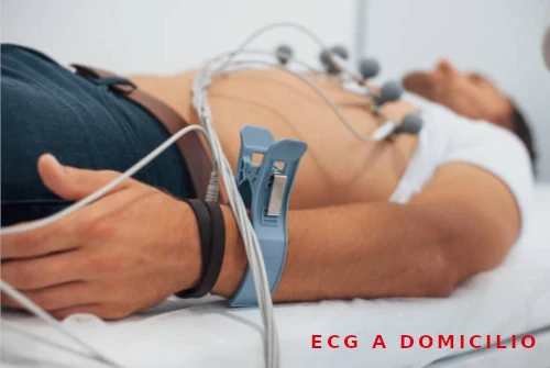 Electrocardiograma a Domicilio en Almagro