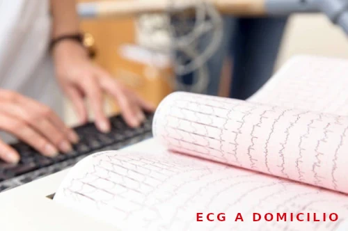 Electrocardiograma a Domicilio en Retiro